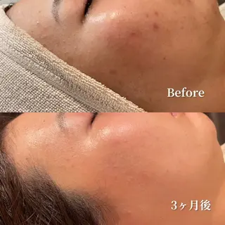 /ulu  soin所属・太田 玲奈のエステ・リラクイメージ