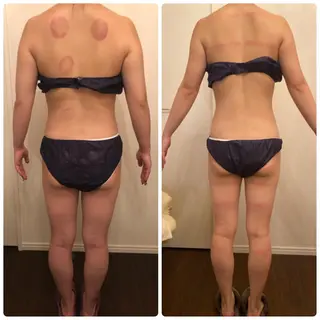 FLEUR大阪・美容 整体・痩身・小顔のエステ・リラクイメージ