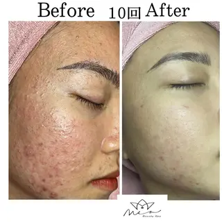 Mia beauty所属・MiA Beautyのエステ・リラクイメージ