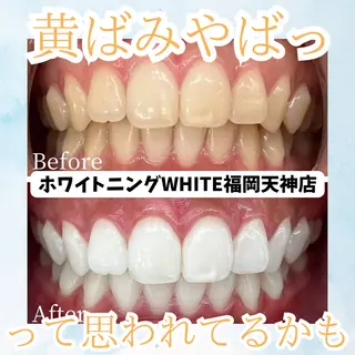 メンズ ホワイトニング専門店 WHITE天神店のエステ・リラクイメージ