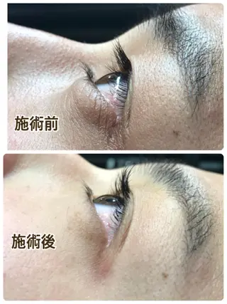 メンズ マツエク・マツパ DxD ディーディのネイルデザイン