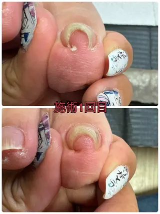 ネイル nail salon -TOIRO-所属・-TOIRO- Eriのネイルデザイン