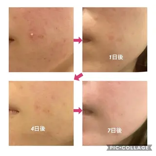 🌿小顔・痩身・脱毛 レイビス川崎店🌿のエステ・リラクイメージ