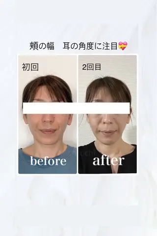 小顔と ヘッドスパのお店のエステ・リラクイメージ