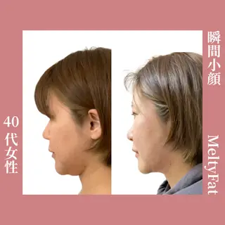 痩身•小顔•ツヤ肌 810神戸元町店のエステ・リラクイメージ