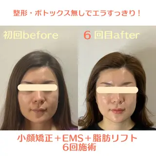 最速小顔・肌質管理 ❣️エスポワールのエステ・リラクイメージ