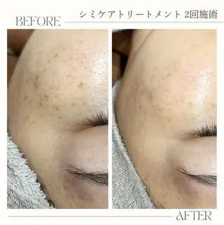 シミ・肌育サロン Jullyのエステ・リラクイメージ