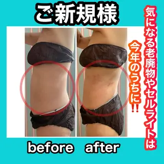 痩身/脱毛/ネイル HARUKAのエステ・リラクイメージ