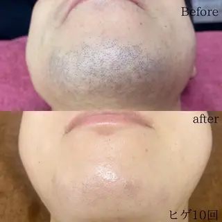 ニキビ、痩身、脱毛、 サクラチャンスパのエステ・リラクイメージ