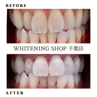メンズ ホワイトニング ショップ千葉店のその他イメージ