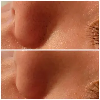 メンズ アイブロウ B&H所属・頭痛•肩こり専門/ 眉サロンB&H心斎橋のエステ・リラクイメージ