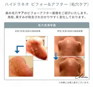 Cherie(シェリー)所属・吉野 京子のエステ・リラクイメージ