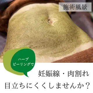 ハーブピーリング・毛穴ケア専門サロンSalon de LENA所属・ハーブピーリング 専門店/名古屋駅前店のエステ・リラクイメージ