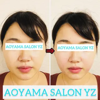 小顔美容鍼専門サロン 渋谷YZのエステ・リラクイメージ