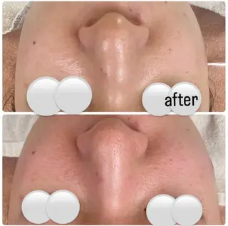 ネイル Private salon Dux所属・肌管理&nail Salon  Duxの眉毛・アイブロウイメージ