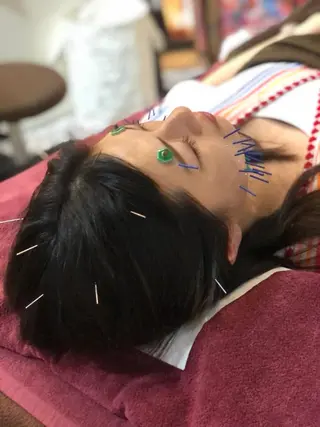 美容鍼灸女性専用 りんご鍼灸治療院のその他イメージ