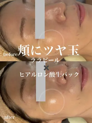 WHITE AQUA 北千住店のエステ・リラクイメージ