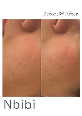 韓国🇰🇷価格 サロン_Nbibiのエステ・リラクイメージ