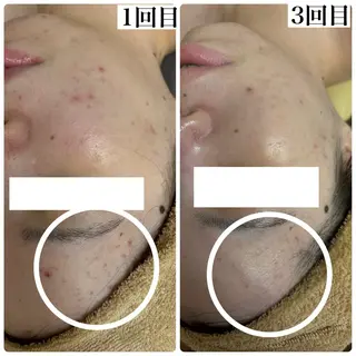 WHITE AQUA 北千住店のエステ・リラクイメージ