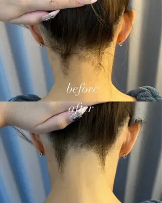 うなじ脱毛/美肌脱毛 LABELのエステ・リラクイメージ