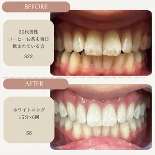 メンズ ホワイトニング カラット 恵比寿店のエステ・リラクイメージ