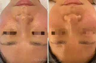 肌質改善 KALANCHOEのエステ・リラクイメージ