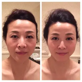 美容鍼サロン    Fleurir所属・伊藤 かなえのエステ・リラクイメージ