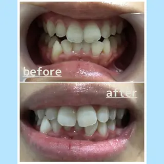 メンズ お手軽ホワイトニングsalon mina所属・武元 奈津美のその他イメージ