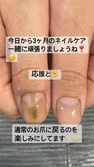 ネイル 奥園 良恵のネイルデザイン