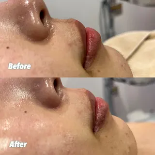 🫧美しい素肌へ🫧 今成柚乃のその他イメージ