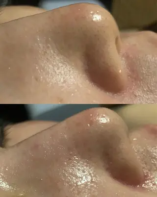 lymph care 'Welnəsのエステ・リラクイメージ