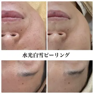 肌質管理専門店 Lé pia　AMIのエステ・リラクイメージ