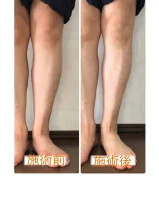 小顔・毛穴・たるみ ネイル　似内真樹のエステ・リラクイメージ