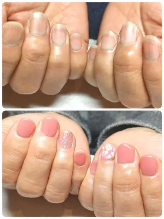 ネイル 深爪矯正/爪育成ケア manie nailのネイルデザイン