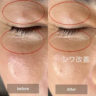 目元・まつパ・美肌フ ェイシャル谷町四丁目のマツエク・マツパデザイン