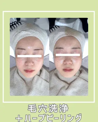 s o i n a🤍🪽ララピール／毛穴／小顔／水光肌所属・s o i n a 神楽坂のエステ・リラクイメージ