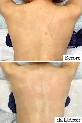 Mignon所属・mignon /栄のエステ・リラクイメージ