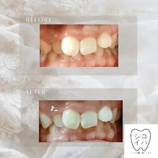 ホワイトニングサロン シロイハ所属・歯を白くしたい方🦷 シロイハのその他イメージ