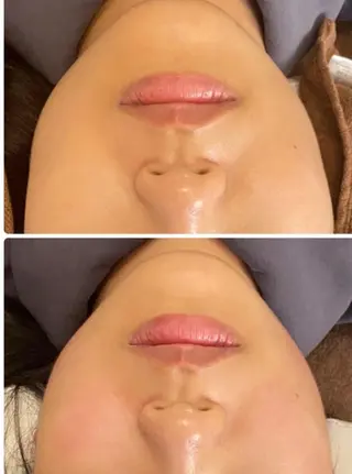 ■超絶小顔&肌管理室■所属・🦋整形級の究極美顔 本格韓国式小顔🦋のエステ・リラクイメージ