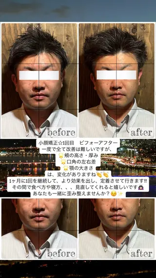 💎後悔させない小顔 矯正💎イトヤマ🌱のエステ・リラクイメージ