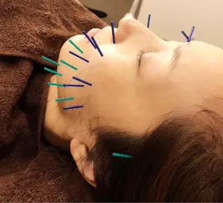 美容鍼灸女性専用 りんご鍼灸治療院のその他イメージ