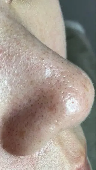 毛穴ケア専門サロン Yourmeユアミーのエステ・リラクイメージ