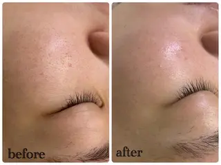 デ・アイム新潟北所属・サイトウ .のエステ・リラクイメージ