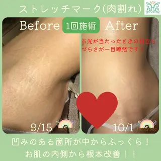 剥離するハーブ🌈 Honey Sideのエステ・リラクイメージ