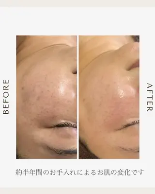 1st｜フェイシャル エステ専門店のエステ・リラクイメージ