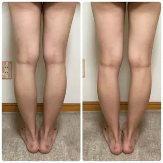 やまだ鍼灸接骨院（やまだしんきゅうせっこついん）所属・山田 晃のエステ・リラクイメージ