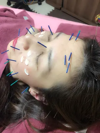 美容鍼灸女性専用 りんご鍼灸治療院のその他イメージ