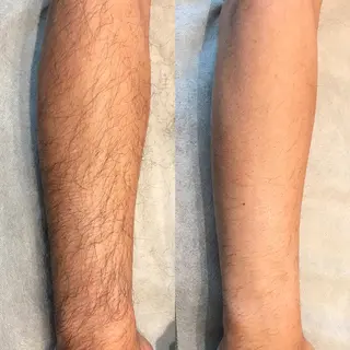 ビューティーサロン リノアのエステ・リラクイメージ