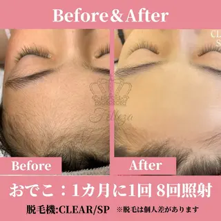 メンズ キッズ 有人型セルフサロン 脱毛/痩身/美顔のその他イメージ