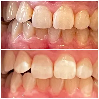 ロング 💎ダイヤモンド ホワイトニング渋谷のその他イメージ